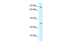 Calumenin Antibody, Novus Biologicals 100 &mu;L; Unconjugated:Antibodies,